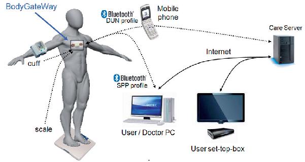 mems in body motion