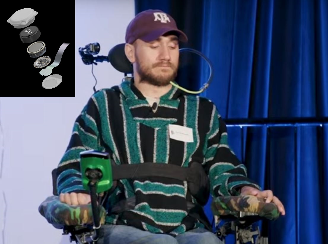 Clinical trial of brain-computer interface Neuralink on 3 people showing results