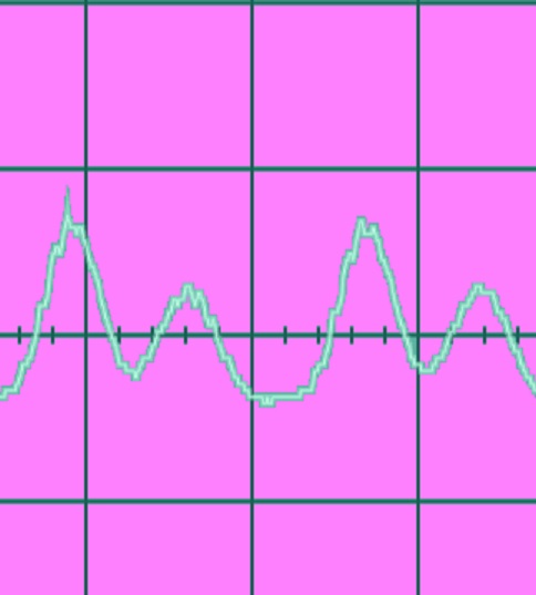 audio